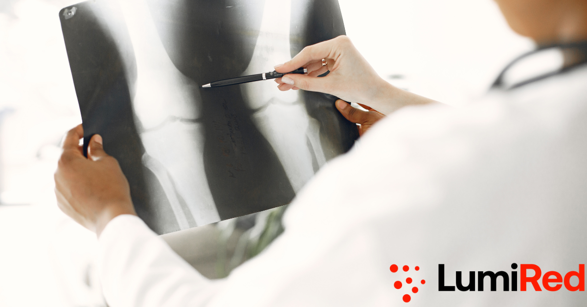 Red Light Therapy for Bone Healing