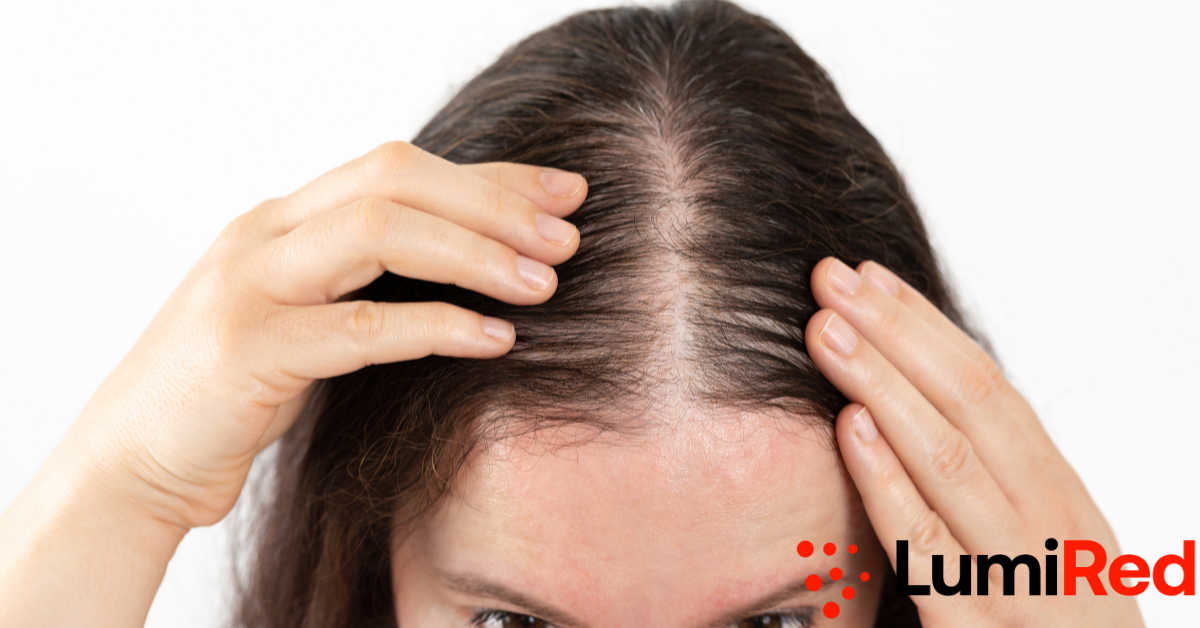 Red Light Therapy for Hair