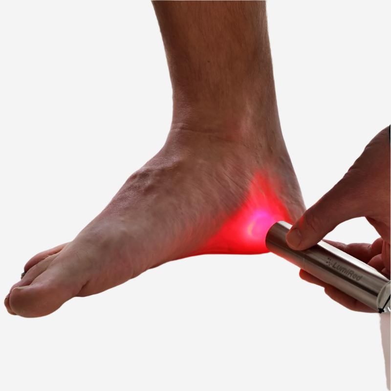 Red light therapy on sale for plantar fasciitis